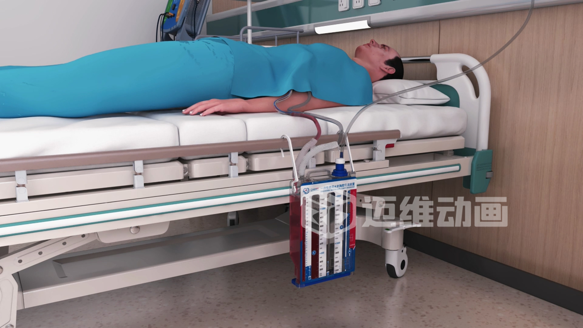 醫(yī)療器械三維動畫：打開精準(zhǔn)傳播與高效溝通的新大門(圖5)